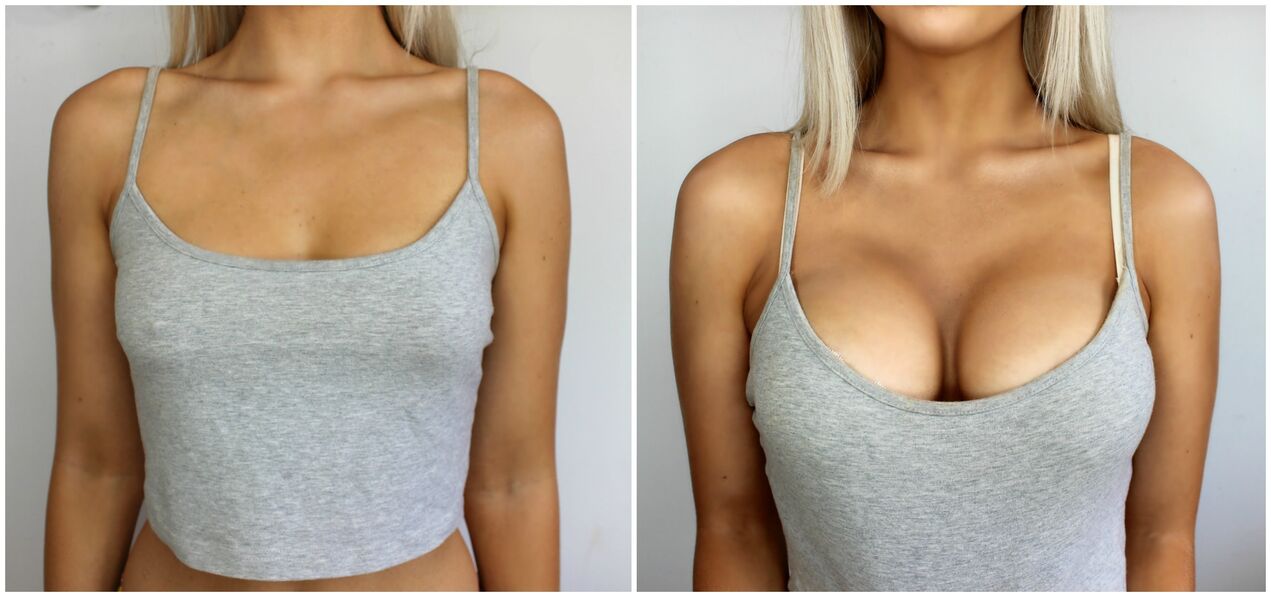 Surgery before and after