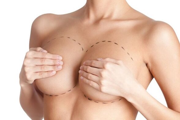 surcharge for breast augmentation surgery